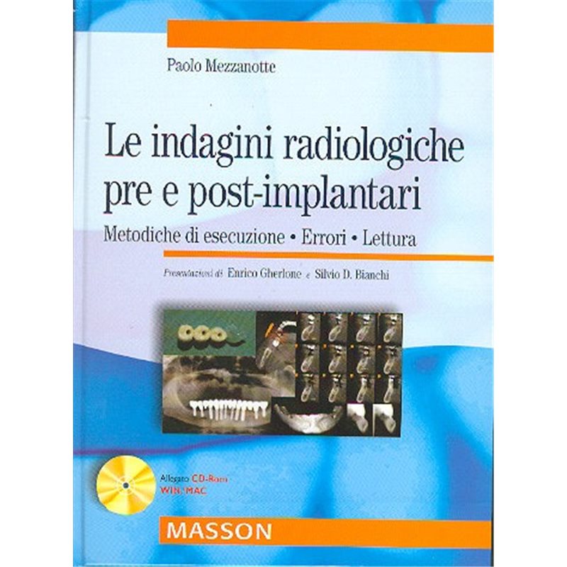 Le indagini radiologiche pre e post-implantari - metodologiche di esecuzione - errori - lettura